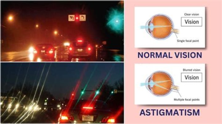 Unravel The Mystery: Astigmatism Lights At Night