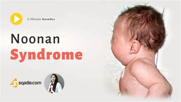 Celebrities Reshaping The Narrative Of Noonan Syndrome