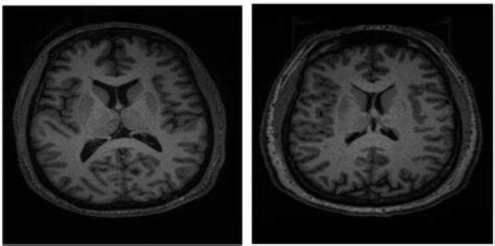 Exploring Kendall Roy's Bipolarity In "Succession"