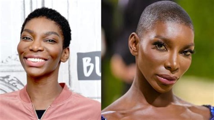 Michaela Coel's Plastic Surgery Journey Unveiled