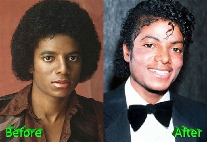 Uncover The Evolution Of Michael Jackson: Before And After