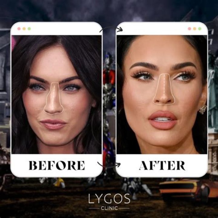 Megan Fox's Nose Job And Its Impact