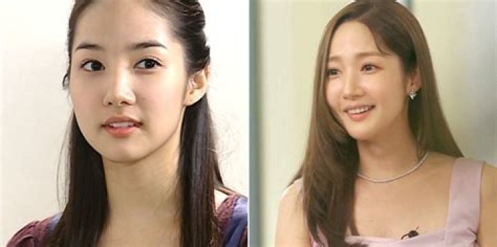 Unveiling Park Min Young's Transformation: Pre-Surgery Insights