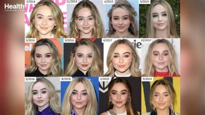 Sabrina Carpenter's Plastic Surgery Journey: Unveiling The Truth